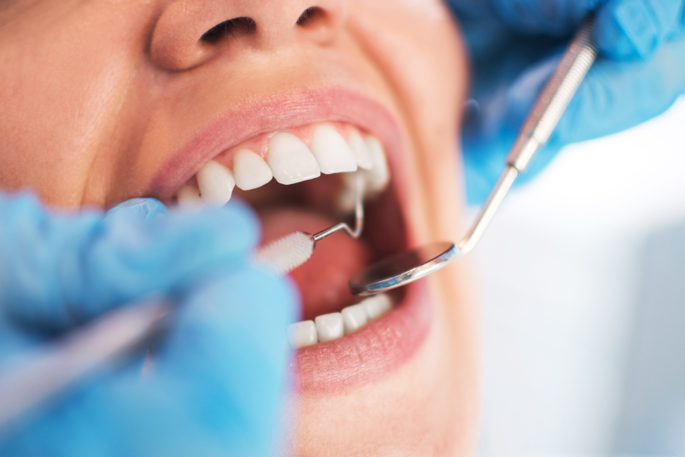 Urgent Dental Care in Lexington: Prompt Relief When You Need It Most